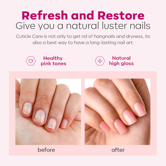 All-in-one Cuticle Remover Kit Nail Care MODELONES #