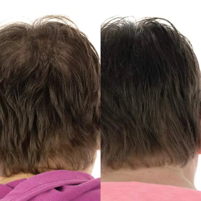 Foligain hair loss shampoo + conditioner women (236 ml) - Hairgivers
