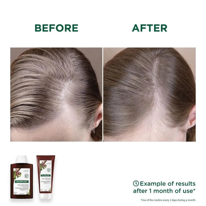 Klorane anti-hair loss conditioner Quinine/Edelweiss (200 ml) - Hairgivers