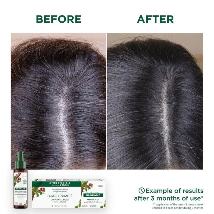 Klorane anti-hair loss serum Quinine/Edelweiss (100 ml) - Hairgivers