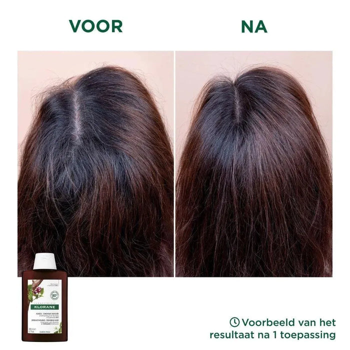 Klorane anti-hair loss shampoo Quinine/Edelweiss (400 ml) - Hairgivers