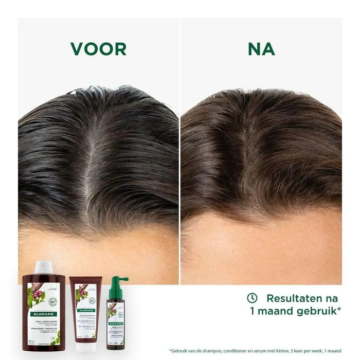Klorane anti-hair loss treatment - Hairgivers