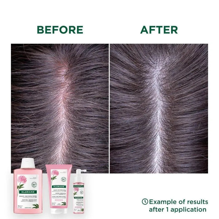 Klorane shampoo Peony - sensitive scalp (400 ml) - Hairgivers