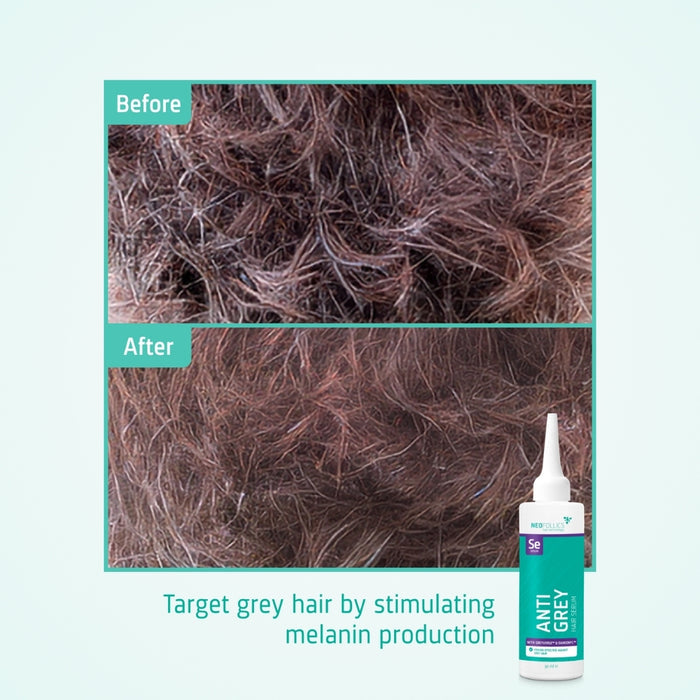 Neofollics anti-grey serum