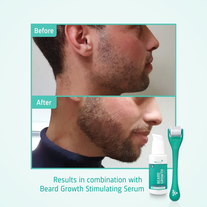 Neofollics beard growth kit