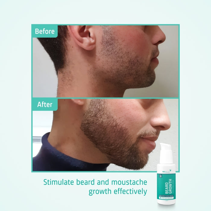 Neofollics beard growth serum 3-pack (7% Neoxyl)