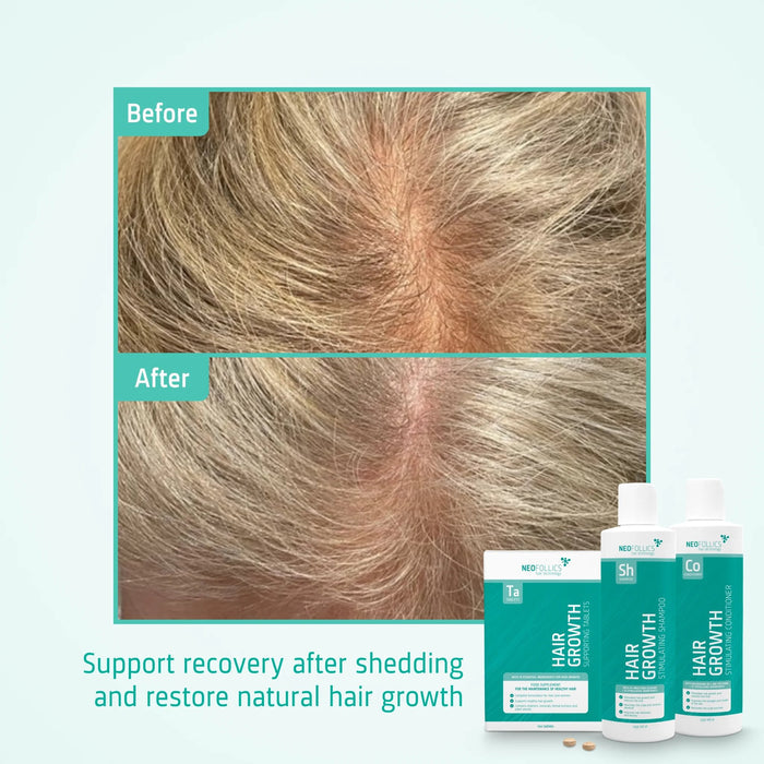 Neofollics Shampoo + Conditioner + Tablets