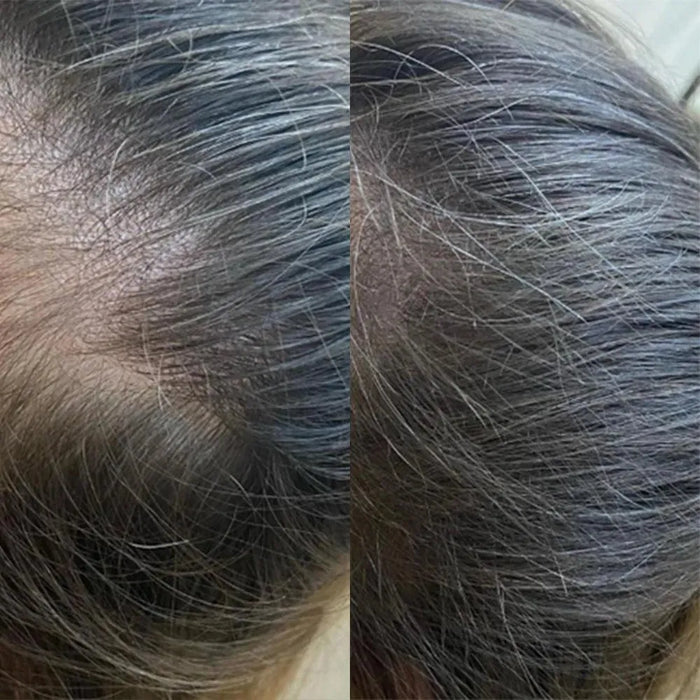 Panthrix hair growth serum (Redensyl) - Hairgivers