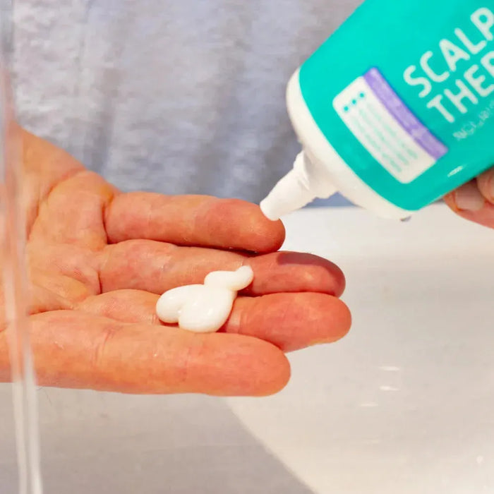 Seborrheic dermatitis scalp treatment - Hairgivers