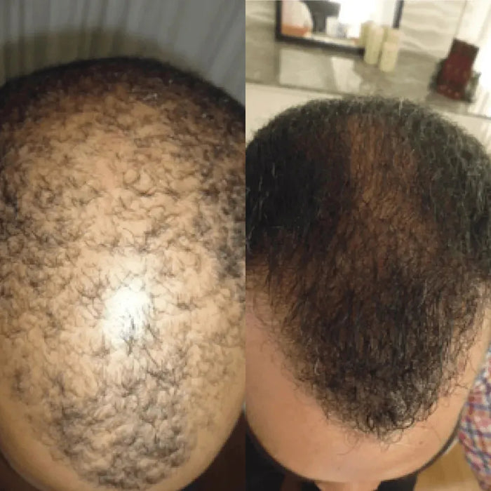 Spectral.DNC-N lotion 3-pack (3x60 ml) - Hairgivers