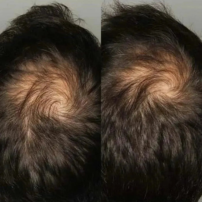Viviscal hair growth tablets for men (1 month) - Hairgivers