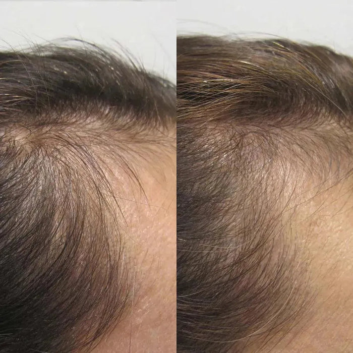 Viviscal hair growth tablets for women (3 months) - Hairgivers