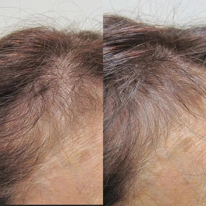 Viviscal hair growth tablets for women (3 months) - Hairgivers